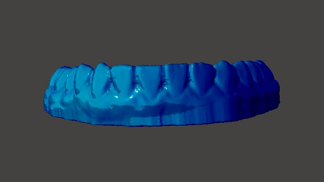 Modelo 3D de arcada dental