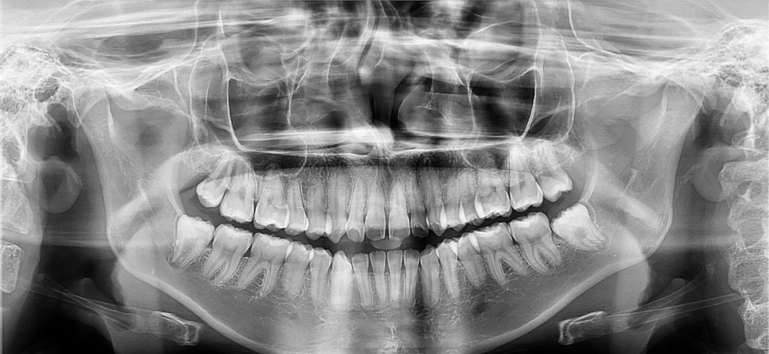 Radiografía panorámica dental