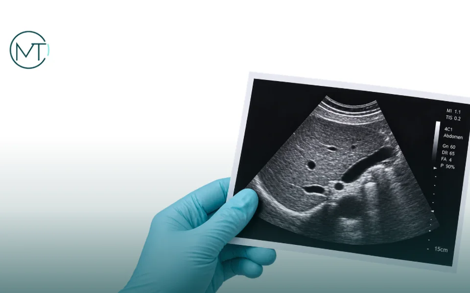 Impresión de un ultrasonido abdominal sostenida por una mano con guante, en Clínica Montero